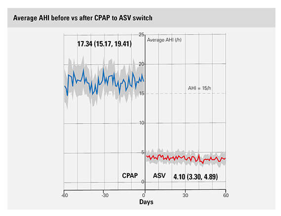 Gráfico que muestra AIH promedio antes y después del cambio a ASV 